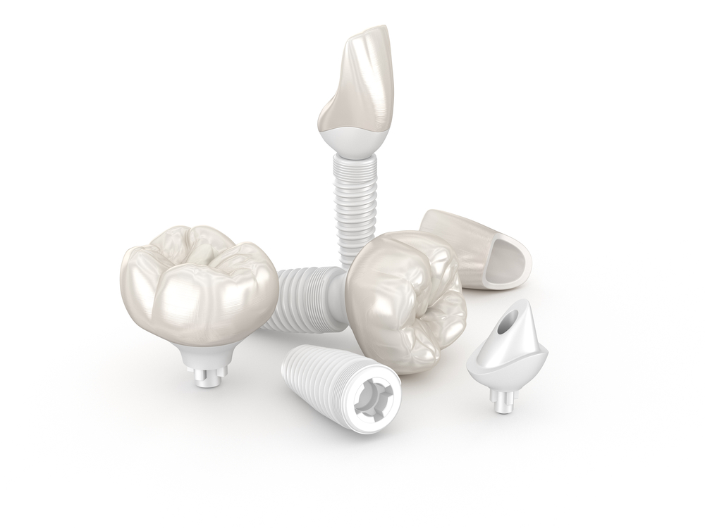 ceramic dental implants and crowns