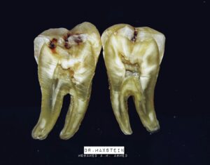 cross-section of human tooth 